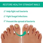 Nail Fungus Solution, Anti Infection Nail Fungus Removal Gel, Ingrown Toenail Treatment Nail Care Oil, Nail Fungus Treatments Serum - Image 2