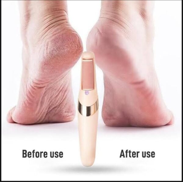 Electric Foot Callus Remover for Feet