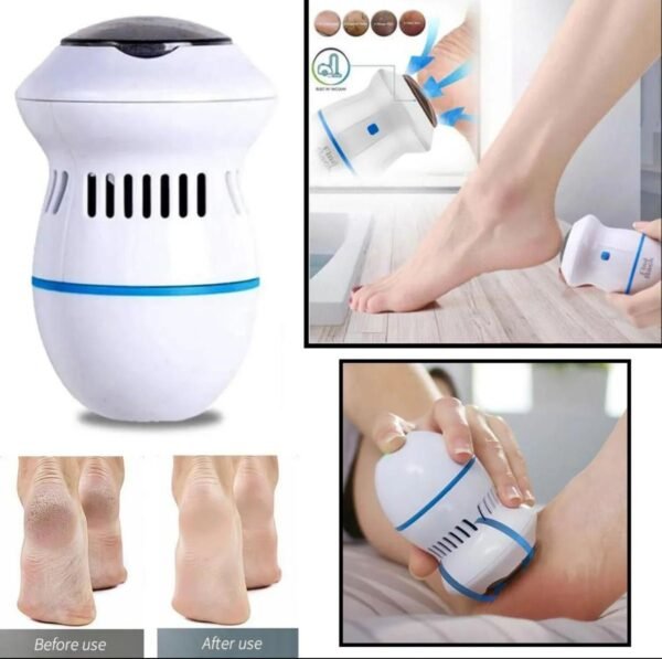 Cellus foot care callus remover
