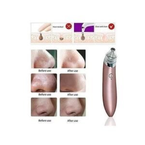5in1 Rechargeable Black Head Remover Derma Vacuum Suction - Durable Design