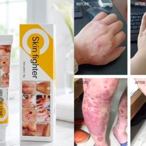 Pei Mei Skin Fighter Cream