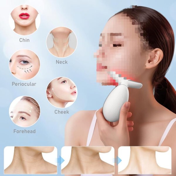 Generic Intense Pulsed Light Wrinkles Reducing Instrument Facial Machine Anti Aging Skincare Device Modern Style - Best