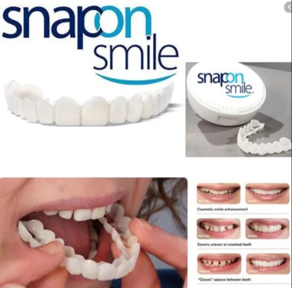 snap-on-smile-veneers-teeth-for-men-and-women-moldable-false-artificial-braces-teeth-kits-1 Snap On Smile Veneers Teeth For Men And Women Moldable False Artificial Braces Teeth Kits - for Home Use